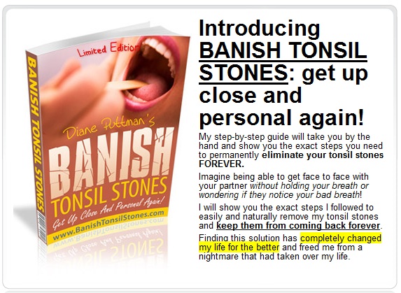 banish tonsil stones diane puttmans
